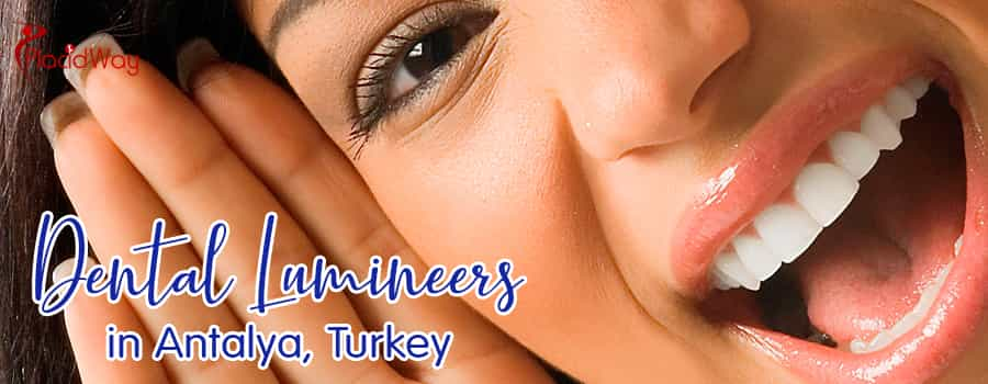 Dental Lumineers in Antalya, Turkey